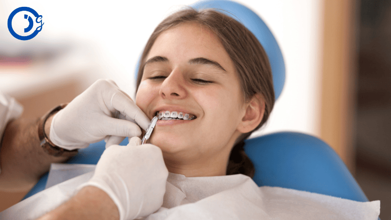 Common Misunderstandings About Braces Costs