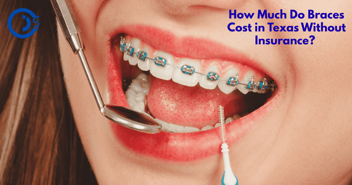 Braces Cost in Texas Without Insurance