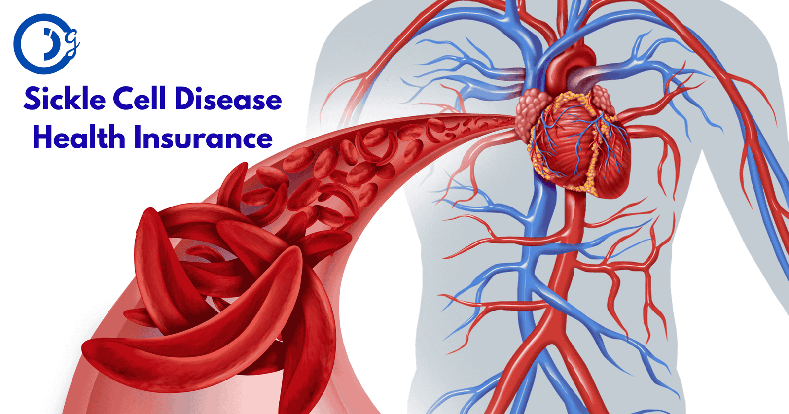 Sickle Cell Disease Health Insurance