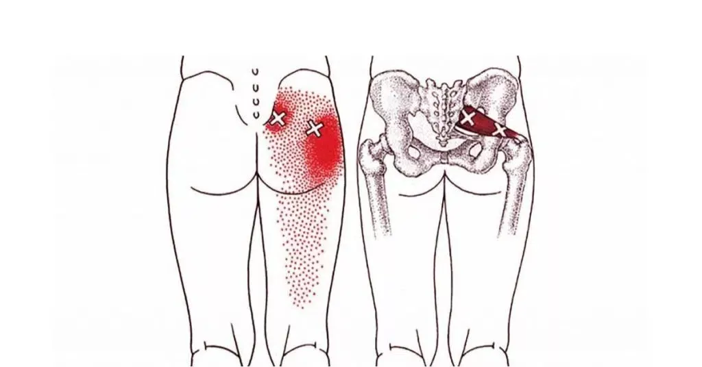 imgi_2_Piriformis-Stretches-Get-Rid-Of-Sciatica-Hip-And-Lower-Back-Pain-1024x536-1.jpg
